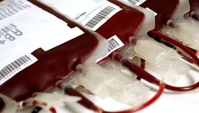 Estudio revela que transfusiones de sangre ayudan a pacientes de Alzhéimer