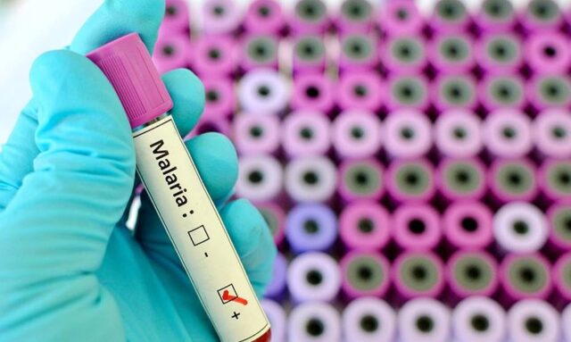 Hallan en un grupo de células una capacidad desconocida para combatir la malaria