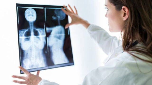Qué es el cáncer de mama metastásico y cómo puedes reconocer sus síntomas: “Me sentía una hipocondríaca por ir al médico todo el tiempo”