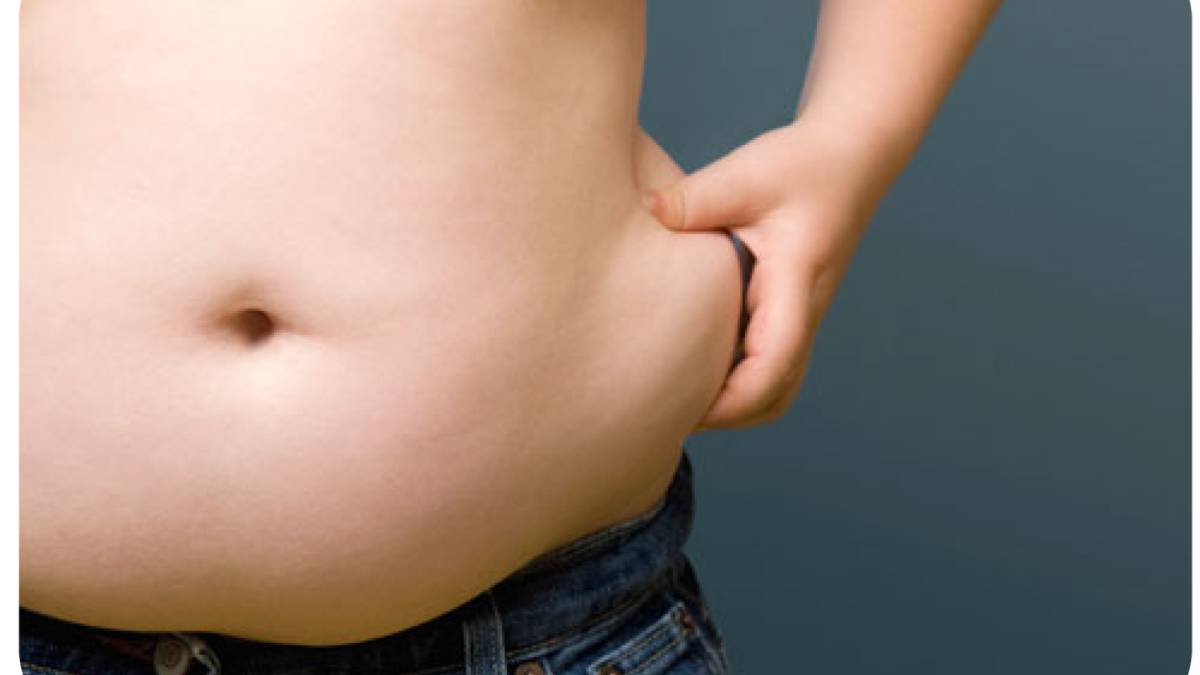 Obesidad