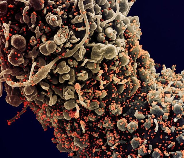 Esto es lo que los virólogos sabemos hasta hoy sobre el coronavirus SARS-CoV-2