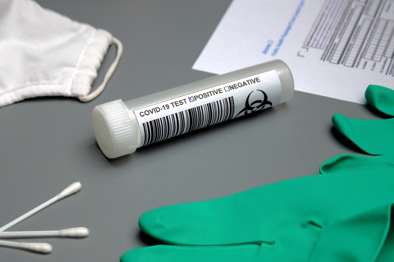 pixabay-prueba-coronavirus