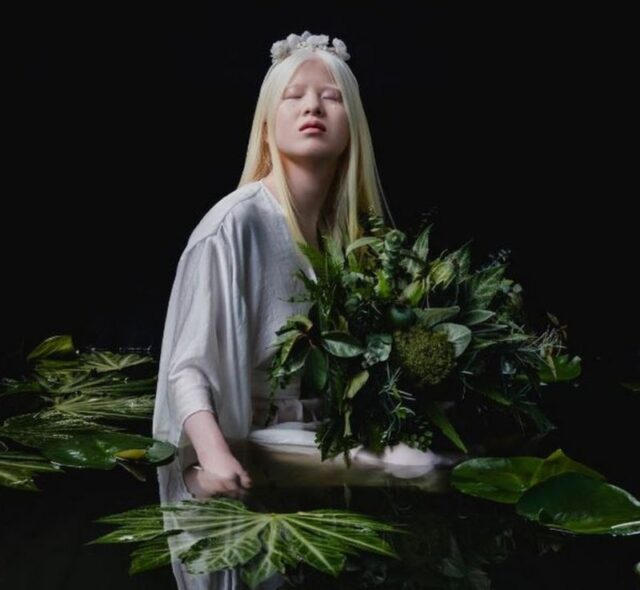 La bebé albina abandonada en China que se convirtió en modelo de Vogue