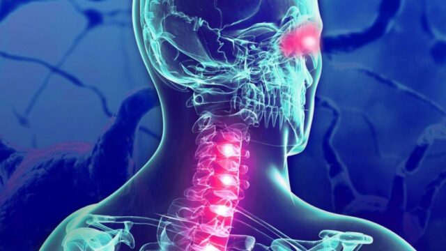 ¿Cómo la hipertensión arterial acelera la aterosclerosis?