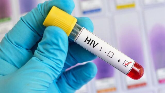OMS alerta de subida de infecciones de VIH sin diagnosticar en región europea