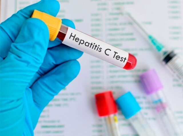 OMS eleva a 650 los casos de hepatitis infantil aguda de origen desconocido