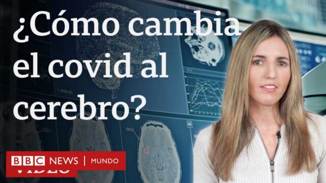 Covid: el estudio que muestra cómo cambia el cerebro tras una infección por coronavirus, aunque esta sea leve