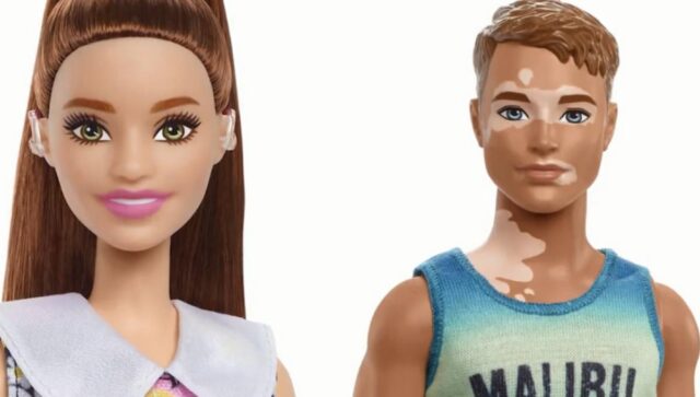 Lanzan Barbie con audífono para discapacidad auditiva y Ken con vitiligo