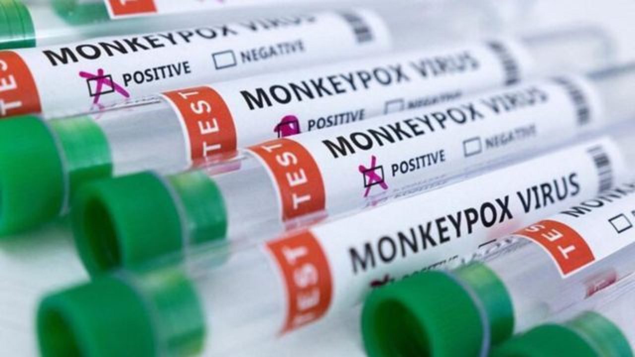Monkeypox-1280x720-1