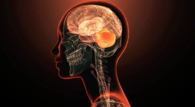 ¿Cómo se desarrolló el cerebro humano? Esto dice la ciencia