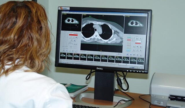 IA predecirá posibles recaídas en pacientes con cáncer