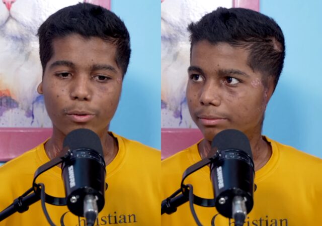 El testimonio de Greiber Berrío, el venezolano atacado por una jauría en Colombia: perdió los brazos y las orejas