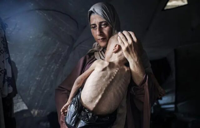 La historia de la foto de Hedaya y su bebé, una de las imágenes más impactantes de la hambruna en Gaza