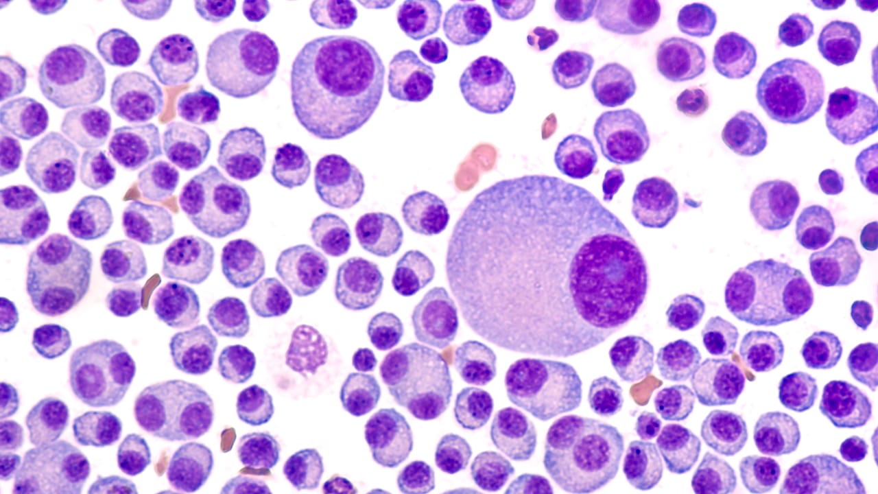 La Unión Europea aprueba el primer tratamiento contra el cáncer con inyector portátil